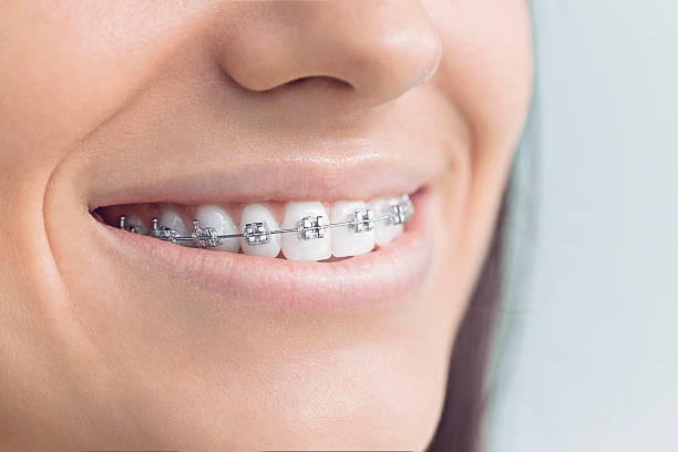 Best Traditional Braces  in Franklin, NJ